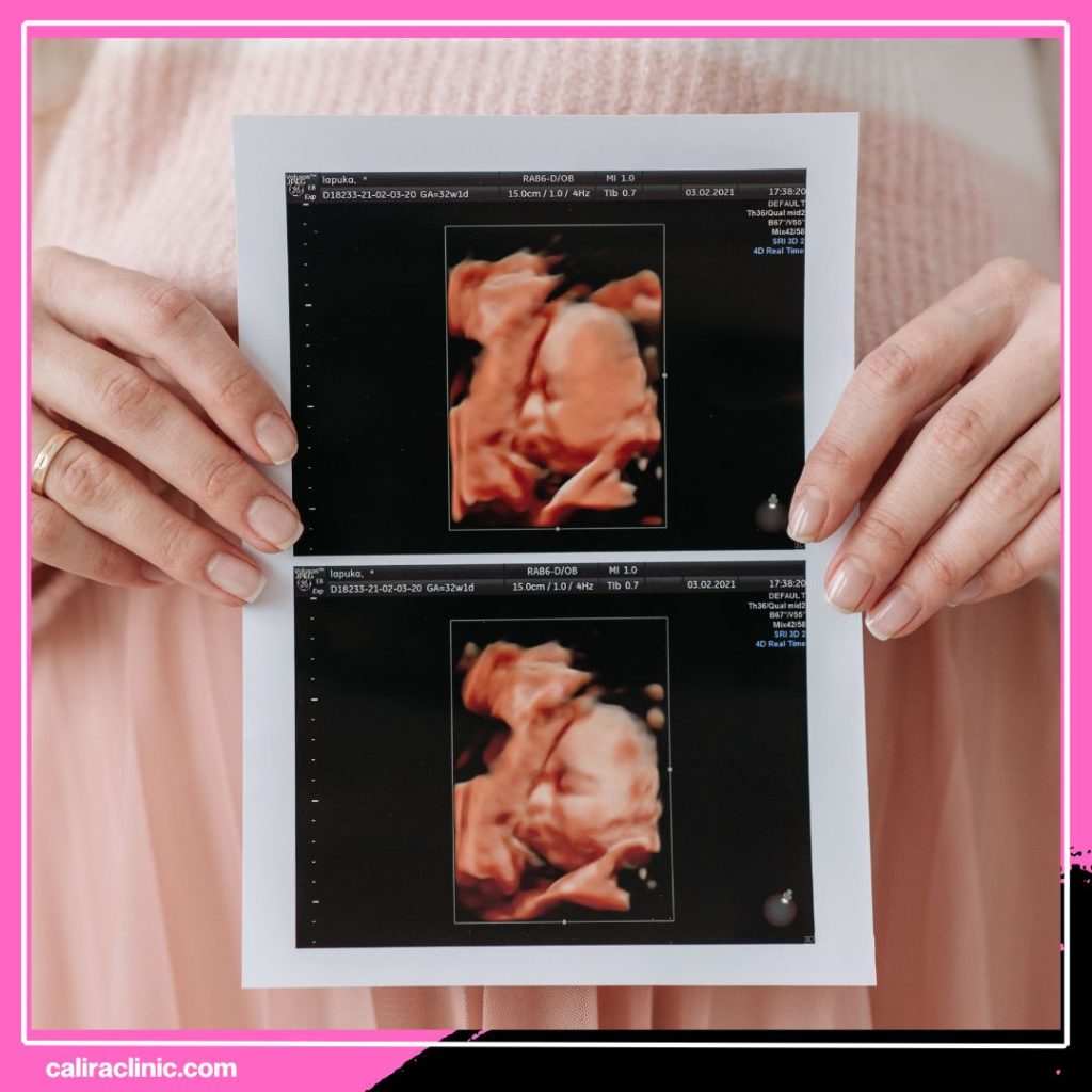 Detail Scan Batu Pahat di Calira Clinic Buat Ibu Lebih Yakin Pantau Perkembangan Si Manja